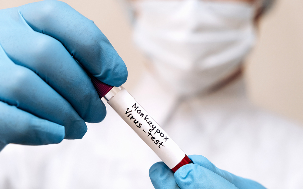 Experts give new names to variants of monkeypox virus