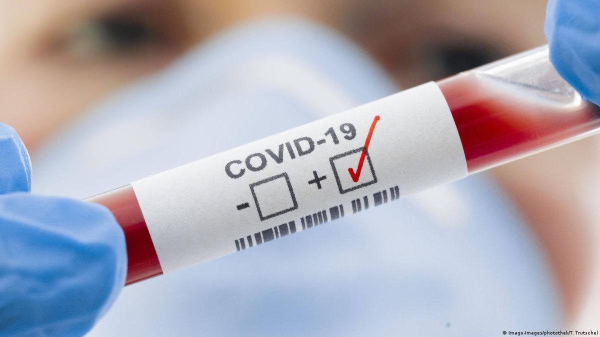 46 new COVID-19 cases reported in Kazakhstan