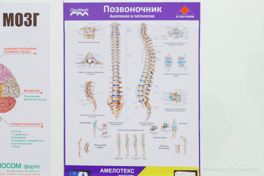 Неврологиялық ауруларға себепші факторлар қандай?